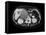 Cystic Pancreas Tumour, CT Scan-ZEPHYR-Framed Stretched Canvas