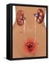 Cystitis (Bladder Infection)-Gwen Shockey-Framed Stretched Canvas