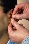 Acupuncturist's Hands Insert Needle Into Man's Ear-Damien Lovegrove-Framed Stretched Canvas