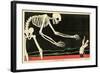 Death and the Kaiser-Paul Iribe-Framed Art Print