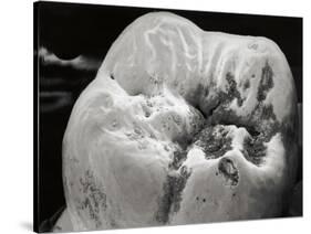 Decay on Molar Tooth, SEM-David McCarthy-Stretched Canvas