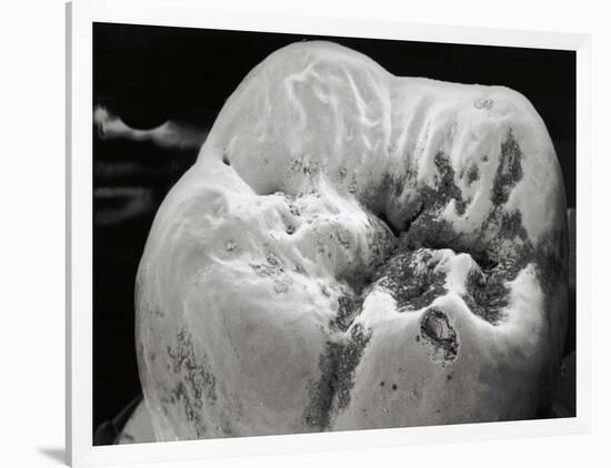 Decay on Molar Tooth, SEM-David McCarthy-Framed Photographic Print