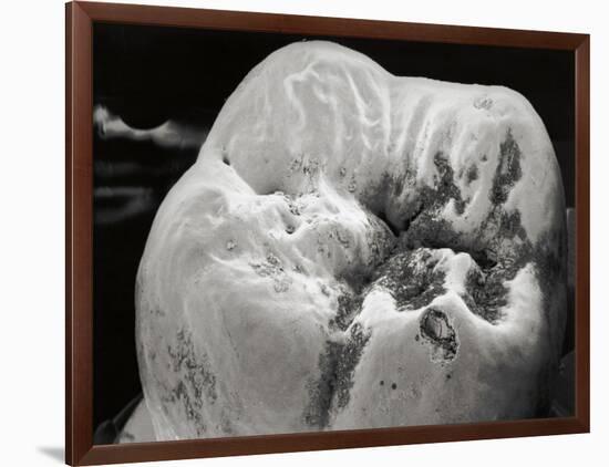 Decay on Molar Tooth, SEM-David McCarthy-Framed Photographic Print