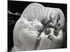 Decay on Molar Tooth, SEM-David McCarthy-Mounted Photographic Print