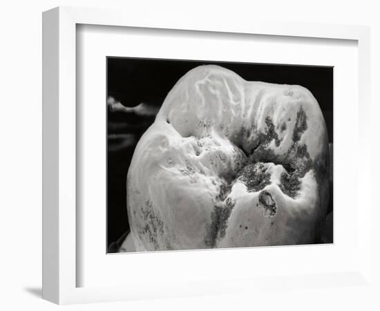 Decay on Molar Tooth, SEM-David McCarthy-Framed Photographic Print