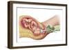 Delivery of Fetus Using Vacuum Extraction Due to Shoulder Dystocia-null-Framed Art Print