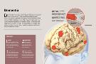 Laminate