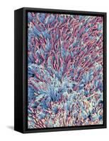 Dental Plaque, SEM-Steve Gschmeissner-Framed Stretched Canvas