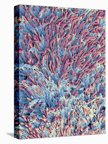 Dental Plaque, SEM-Steve Gschmeissner-Stretched Canvas