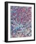 Dental Plaque, SEM-Steve Gschmeissner-Framed Photographic Print