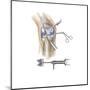 Detail of Human Knee Showing Insertion of Arthroscopic Instruments-null-Mounted Art Print