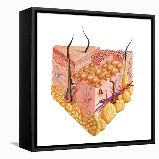 Detailed Cutaway Diagram of Human Skin-null-Framed Stretched Canvas