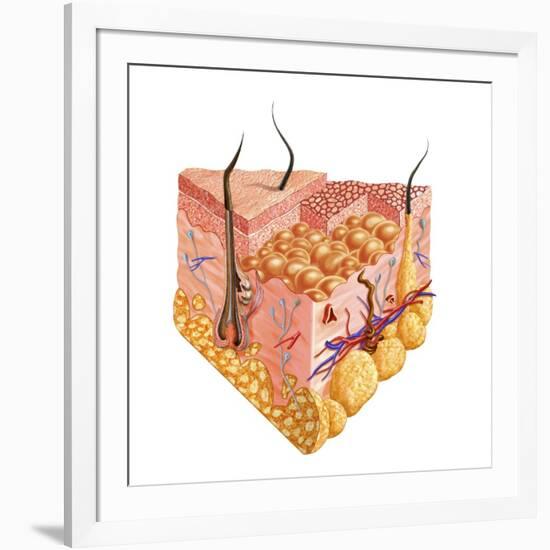 Detailed Cutaway Diagram of Human Skin-null-Framed Art Print