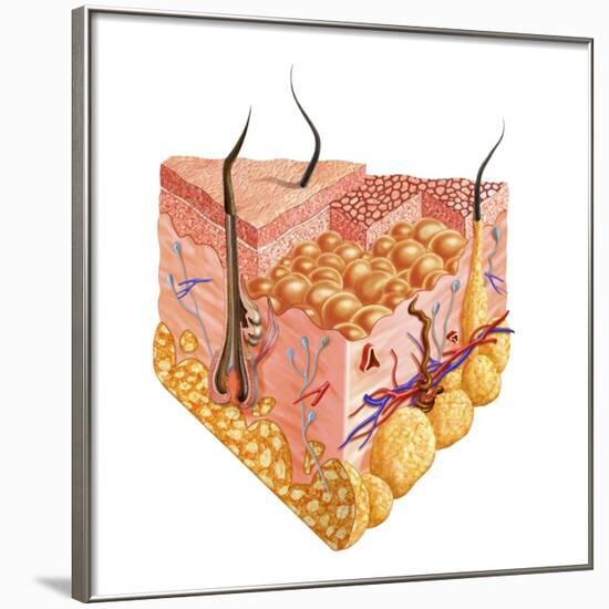 Detailed Cutaway Diagram of Human Skin-null-Framed Art Print