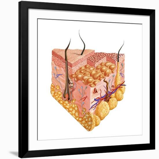 Detailed Cutaway Diagram of Human Skin-null-Framed Art Print