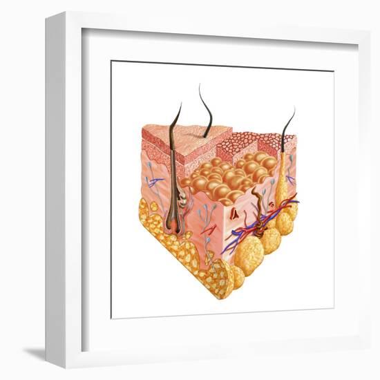 Detailed Cutaway Diagram of Human Skin-null-Framed Art Print