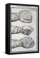 Detailed Views of a Roman Cestus a Leather Glove Used in Ancient Boxing-A. Forbes-Framed Stretched Canvas