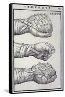 Detailed Views of a Roman Cestus a Leather Glove Used in Ancient Boxing-A. Forbes-Framed Stretched Canvas