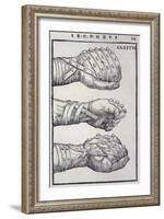 Detailed Views of a Roman Cestus a Leather Glove Used in Ancient Boxing-A. Forbes-Framed Photographic Print