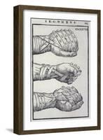 Detailed Views of a Roman Cestus a Leather Glove Used in Ancient Boxing-A. Forbes-Framed Photographic Print