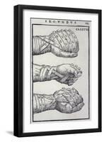 Detailed Views of a Roman Cestus a Leather Glove Used in Ancient Boxing-A. Forbes-Framed Photographic Print