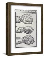 Detailed Views of a Roman Cestus a Leather Glove Used in Ancient Boxing-A. Forbes-Framed Photographic Print