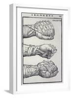 Detailed Views of a Roman Cestus a Leather Glove Used in Ancient Boxing-A. Forbes-Framed Premium Photographic Print