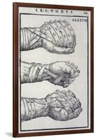 Detailed Views of a Roman Cestus a Leather Glove Used in Ancient Boxing-A. Forbes-Framed Photographic Print