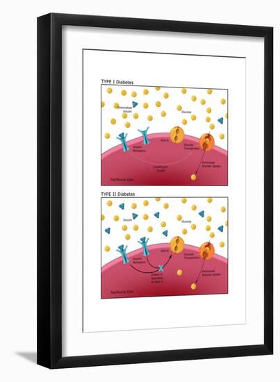 Diabetes I & II-Monica Schroeder-Framed Art Print