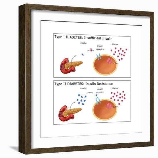 Diabetes I & II-Monica Schroeder-Framed Art Print