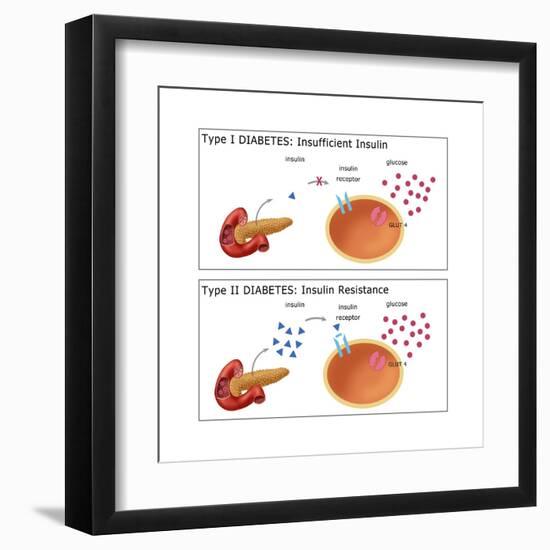 Diabetes I & II-Monica Schroeder-Framed Art Print