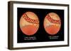 Diabetes I & II-Monica Schroeder-Framed Giclee Print