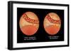 Diabetes I & II-Monica Schroeder-Framed Giclee Print