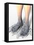 Diabetes-related Foot Problems, Artwork-David Mack-Framed Stretched Canvas