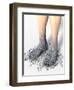 Diabetes-related Foot Problems, Artwork-David Mack-Framed Premium Photographic Print