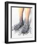 Diabetes-related Foot Problems, Artwork-David Mack-Framed Premium Photographic Print