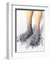 Diabetes-related Foot Problems, Artwork-David Mack-Framed Premium Photographic Print