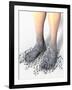 Diabetes-related Foot Problems, Artwork-David Mack-Framed Photographic Print