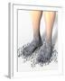 Diabetes-related Foot Problems, Artwork-David Mack-Framed Photographic Print