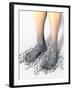 Diabetes-related Foot Problems, Artwork-David Mack-Framed Photographic Print