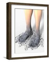 Diabetes-related Foot Problems, Artwork-David Mack-Framed Photographic Print