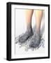 Diabetes-related Foot Problems, Artwork-David Mack-Framed Photographic Print