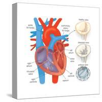Diagram of the Human Heart - Valve Examples-Encyclopaedia Britannica-Stretched Canvas