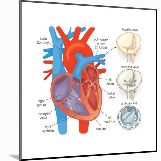 Diagram of the Human Heart - Valve Examples-Encyclopaedia Britannica-Mounted Art Print
