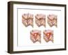 Different Types of Acne, Non-Inflammatory and Inflammatory-null-Framed Art Print