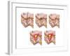 Different Types of Acne, Non-Inflammatory and Inflammatory-null-Framed Art Print