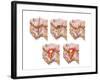 Different Types of Acne, Non-Inflammatory and Inflammatory-null-Framed Art Print