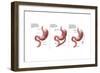 Digestive System: Normal, Gastric Band, Bypass-Gwen Shockey-Framed Premium Giclee Print