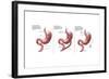 Digestive System: Normal, Gastric Band, Bypass-Gwen Shockey-Framed Art Print