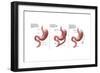 Digestive System: Normal, Gastric Band, Bypass-Gwen Shockey-Framed Art Print